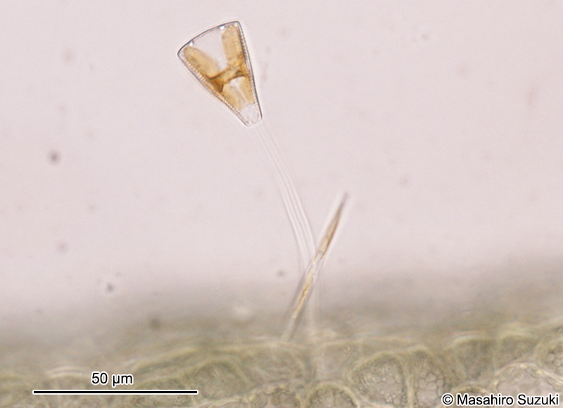 クサビケイソウ Gomphonema